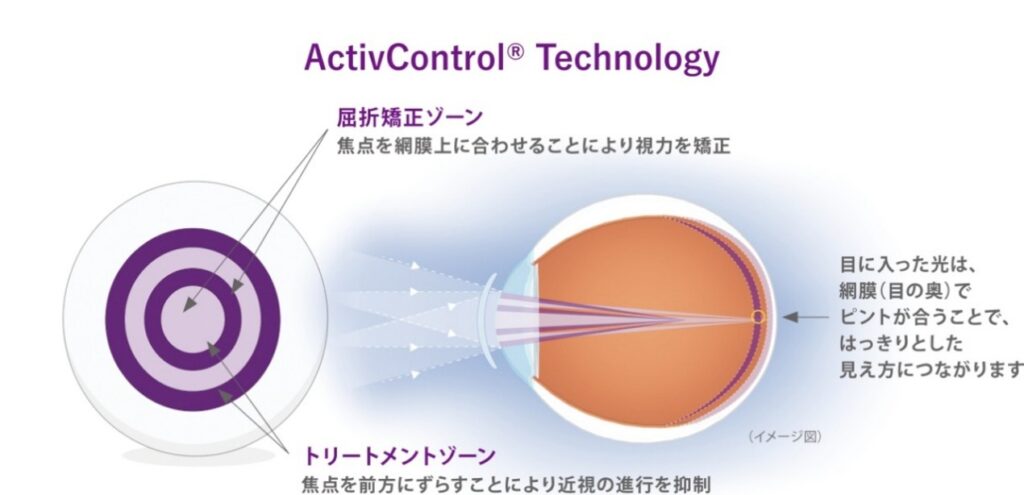 (レンズの構造について)